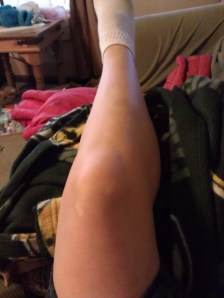 My giant knee